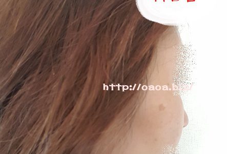 【１４日目】ビーグレンしみケアチャレンジ